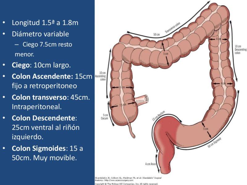 Tumor De Colon Cirujano Monterrey Tumor De Colon Cirujano Monterrey