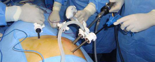 laparoscopia-microcirugia-laser-6